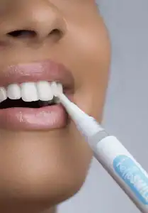 hello smile izbjeljivanje
