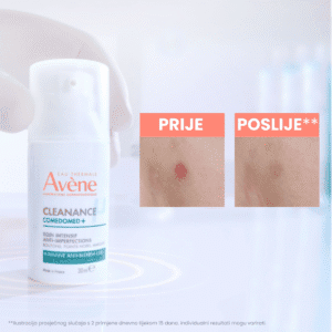 av_cleanance_burst_comedomed_carousel-e-retail_3000x3000_2025_hr (2)