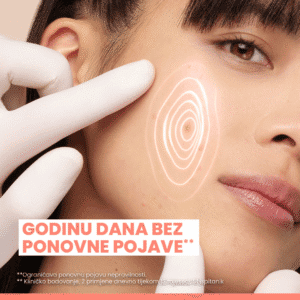 av_cleanance_burst_comedomed_carrousel-collectionad_efficacy_1x1-_5